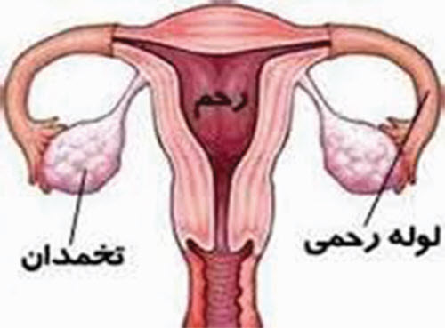 هيستركتومي ابدومينال