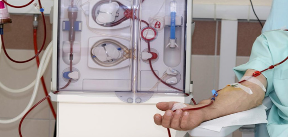 مراقبت از کاتتر یا فیستول   در بیماران دیالیزی