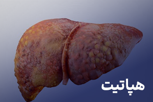 هپاتیت